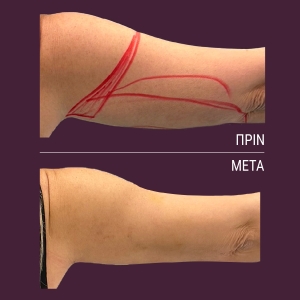 vp-website-before-after-1200x1200-01