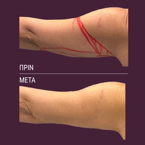 vp-website-before-after-1200x1200-02