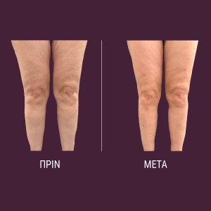 vp-website-before-after-1200x1200-04