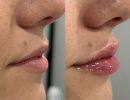 photo gallery before   after 2