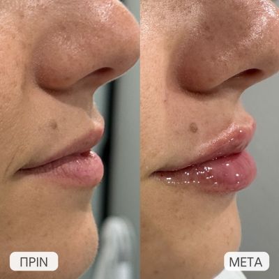 photo gallery before   after 2
