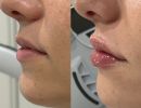 photo gallery before   after 2