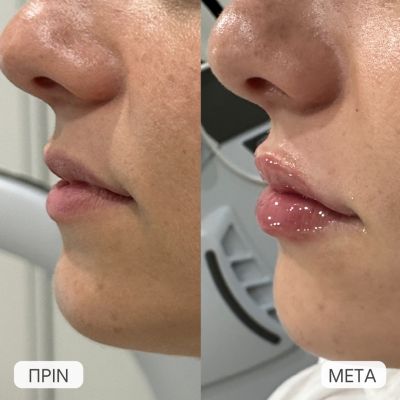 photo gallery before   after 2