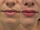 photo gallery before   after 2