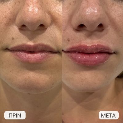photo gallery before   after 2