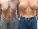 photo gallery before   after