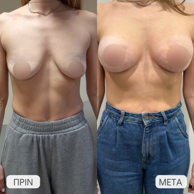 photo gallery before   after