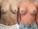 photo gallery before   after