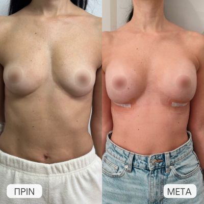 photo gallery before   after