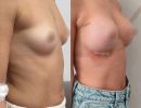 photo gallery before   after