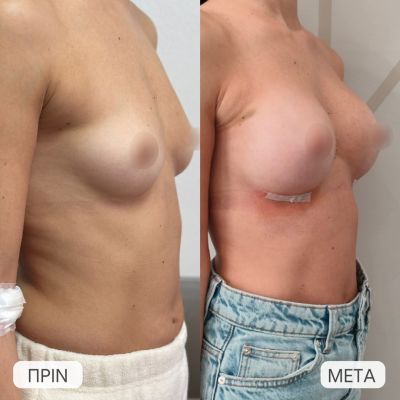 photo gallery before   after