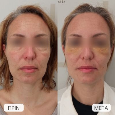 photo gallery before   after