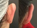 photo gallery before   after 2
