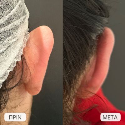 photo gallery before   after 2