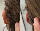 photo gallery before   after 2