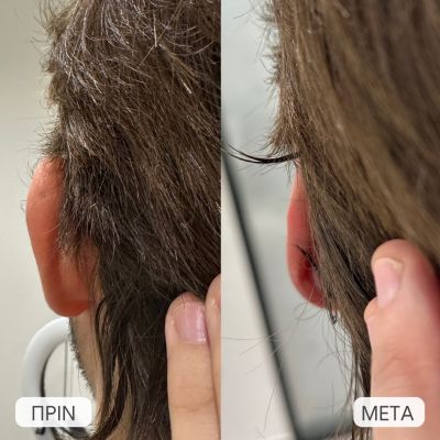 photo gallery before   after 2