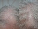 photo gallery before   after