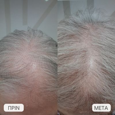 photo gallery before   after