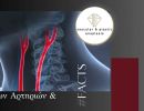 f a q aneurysma koiliakes aortes