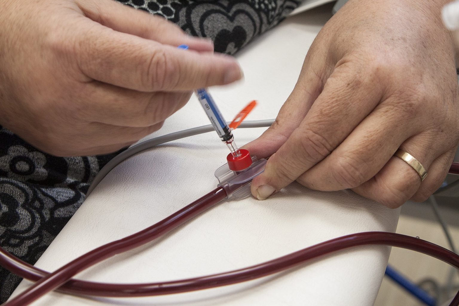 vascular_access_-_AV_fistula_-_practicing_nee.width-2000-1536x1024.jpg
